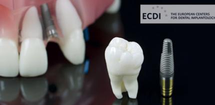 Zahnimplantate in Sopron