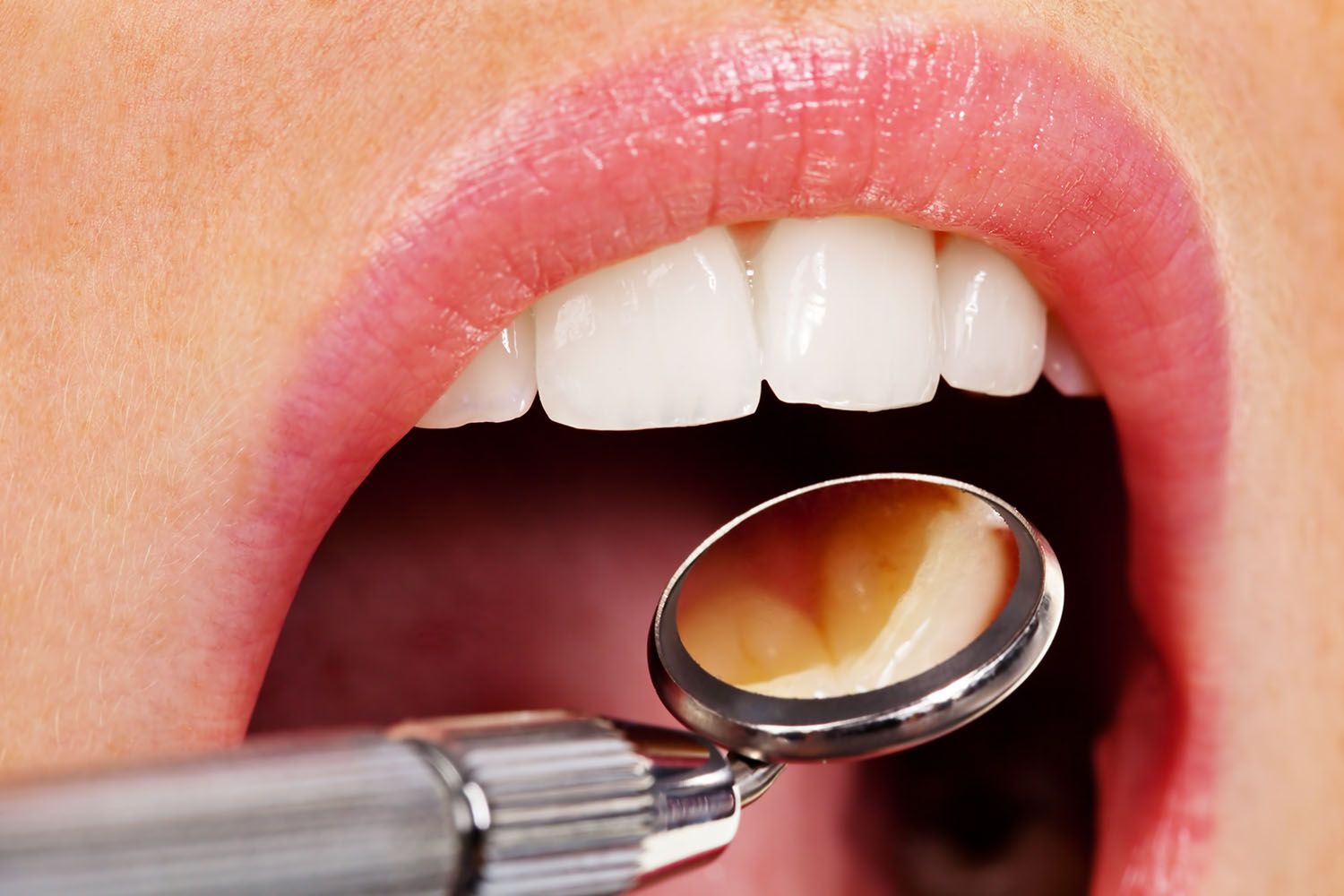 Sopron - fogorvos - fogínybetegség