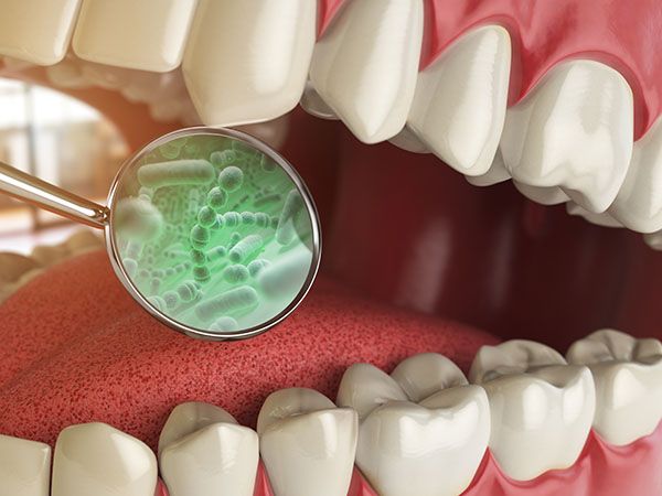 Sopron - Zahnarzt - Mundhygiene